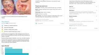 Knowledge Card de santé sur Google après une recherche sur les problèmes de sinusite